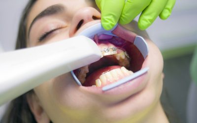 Ortodoncia: Todo lo que debes saber antes de comenzar tu tratamiento.