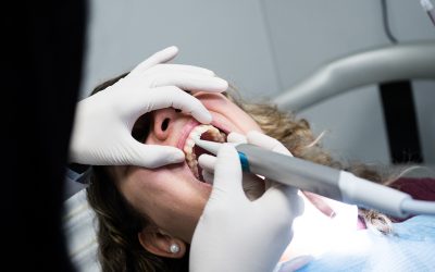 Salud dental y cardiovascular: Conexión vital