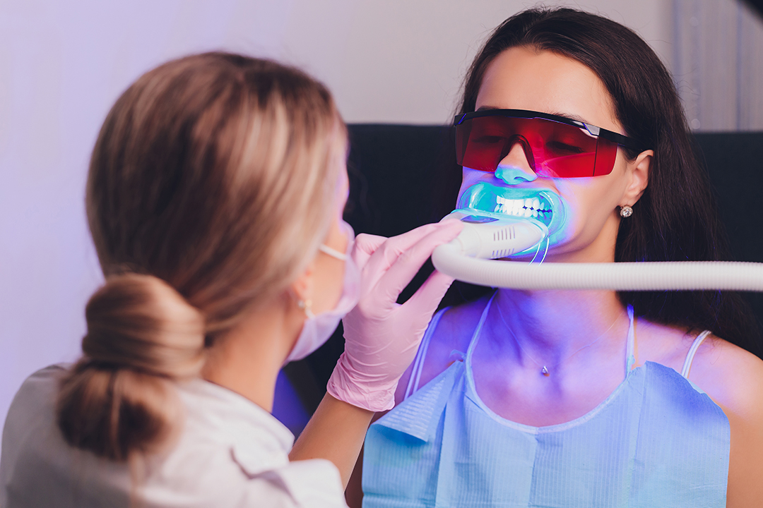 Blanqueamiento dental Paciente sonriendo despues de un tratamiento de blanqueamiento dental.