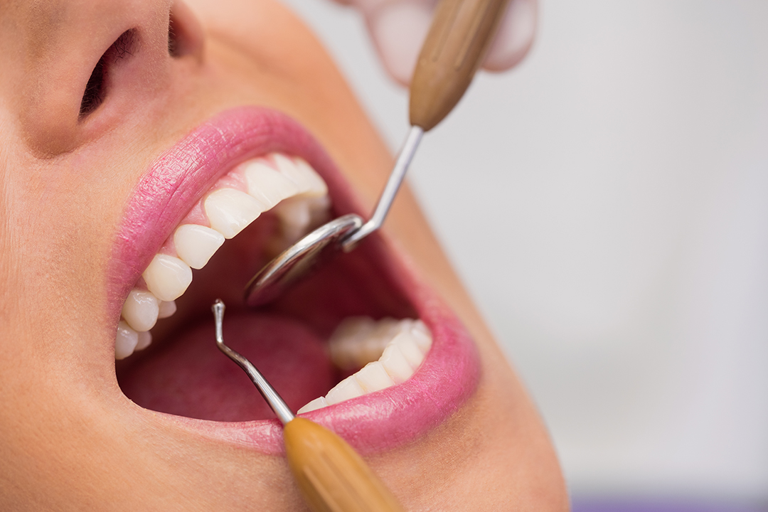 Odontologia dental Paciente en consulta odontologica con dentista realizando revision dental.