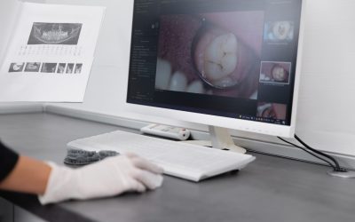 Diagnóstico con cámara intraoral: qué es y por qué mejora tu salud dental