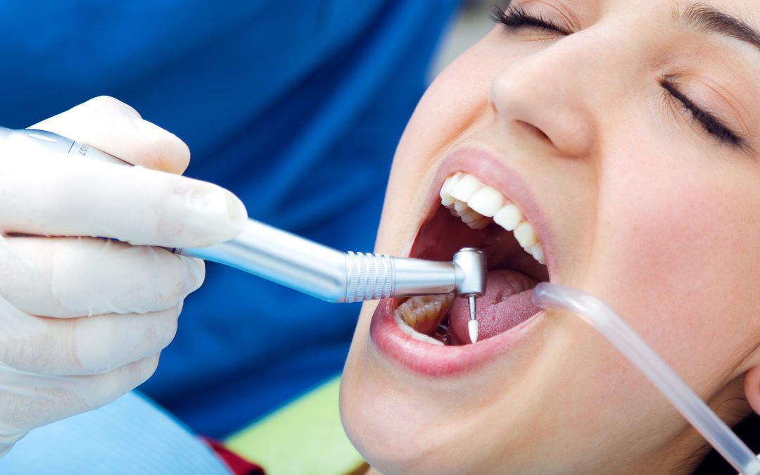 Limpieza dental por ultrasonido en clínica dental